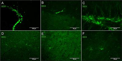 Doublecortin in Oligodendrocyte Precursor Cells in the Adult Mouse Brain